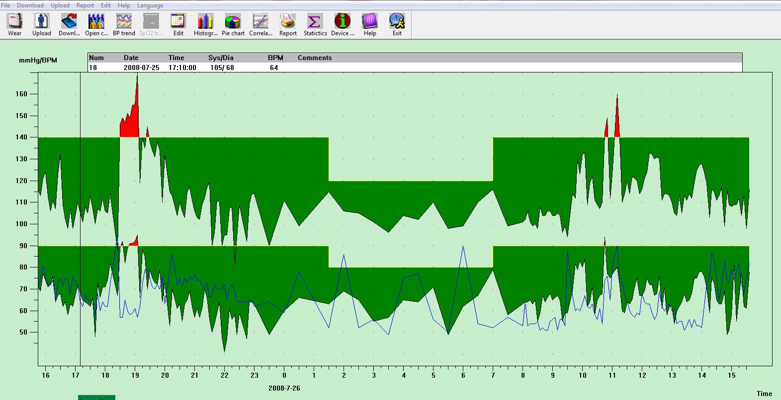 PM50 BP Trend Chart