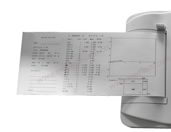 SpirOx pro Spirometer print report, pulsklockor,spirometeros,spirometr,Neumoloxía,Spirometr,Spirometer,spirometer,Neumología,Espirómetro,Spirometria,Spiromètre,Spirométrie,ספירומטר,SpirometriaSpirometro,Compliance polmonare,Спирометрия,Спирометр,Спірометрія,