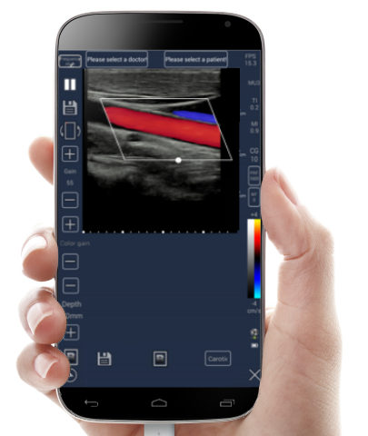 Hillinton tablet ultrasound scanner, color doppler,android doppler,iphone ultrasound scanner