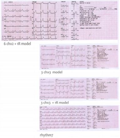 Ecg paper