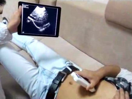 iSono wireless ultrasound