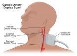 Vascular Studien Ultraschall